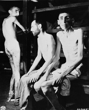 Buchenwald Survivors Buchenwald-Survivors-starvation-fatigue